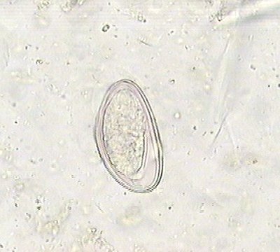 enterobius vermicularis oeuf)